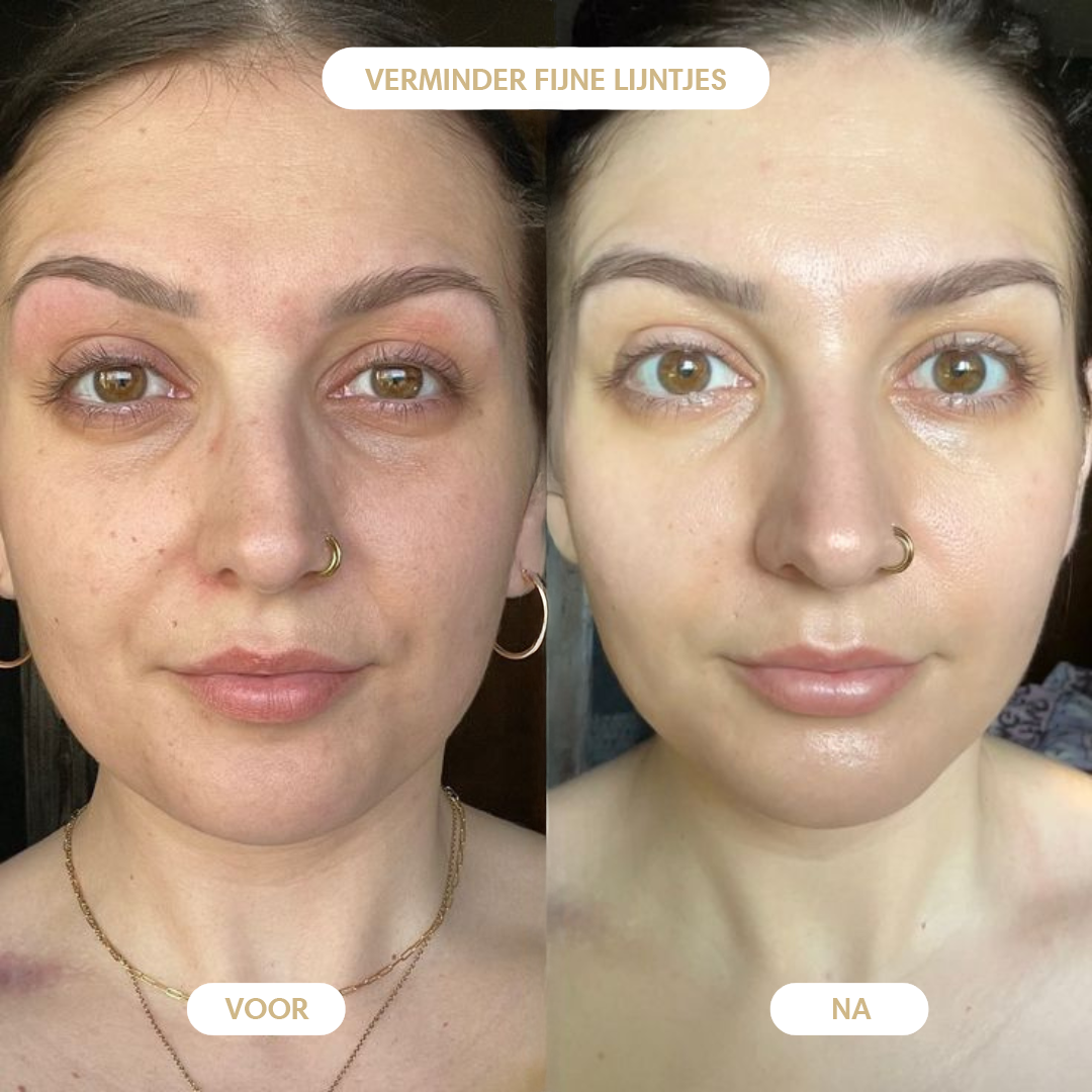 Argan oil 100% - For a Wrinkle-Free, Radiant You