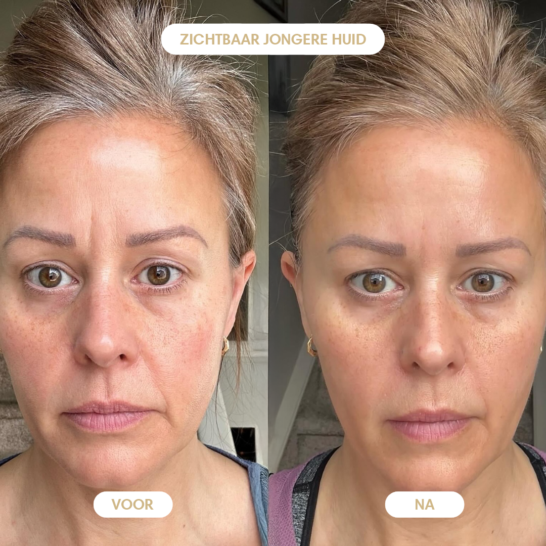 Argan oil 100% - For a Wrinkle-Free, Radiant You